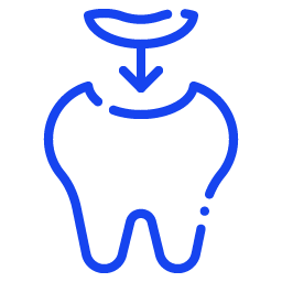 Bleaching / Tooth Whitening